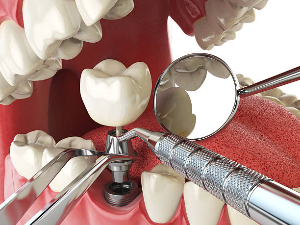 Best Emergency Gum Treatment in Avon, MN