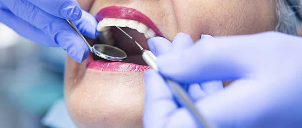 Best Emergency Gum Treatment in Avon, MN